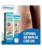 iShopping - Well Mart Lipoma Removal Cream 20g