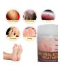 iShopping - Marham Herbal Hand & Feet Moisturizer Balm Cream
