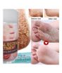 iShopping - Marham Herbal Hand & Feet Moisturizer Balm Cream